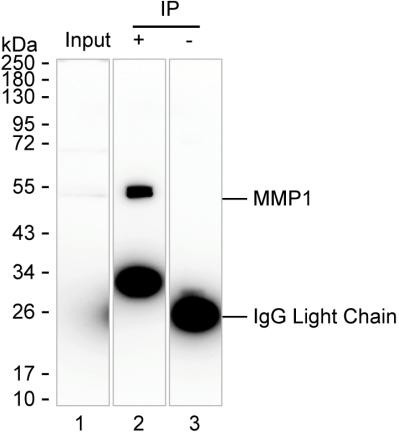 MMP1 Antibody in Immunoprecipitation (IP)