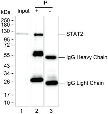 STAT2 Antibody in Immunoprecipitation (IP)