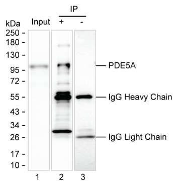 PDE5 Antibody in Immunoprecipitation (IP)