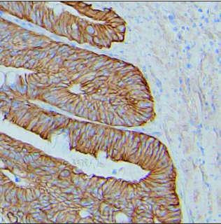 delta Catenin Antibody in Immunohistochemistry (Paraffin) (IHC (P))