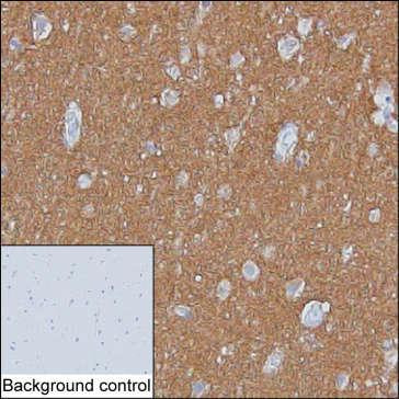 SNAP25 Antibody in Immunohistochemistry (Paraffin) (IHC (P))