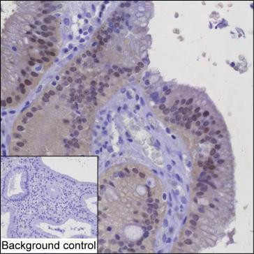 Galectin 2 Antibody in Immunohistochemistry (Paraffin) (IHC (P))