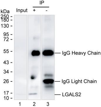 Galectin 2 Antibody in Immunoprecipitation (IP)