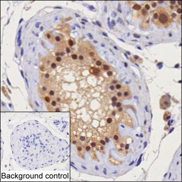 PSMD1 Antibody in Immunohistochemistry (Paraffin) (IHC (P))