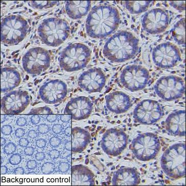 CHOP Antibody in Immunohistochemistry (Paraffin) (IHC (P))