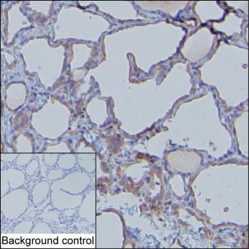 MDA5 Antibody in Immunohistochemistry (Paraffin) (IHC (P))