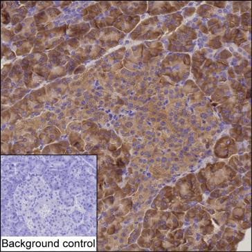 CARS Antibody in Immunohistochemistry (Paraffin) (IHC (P))