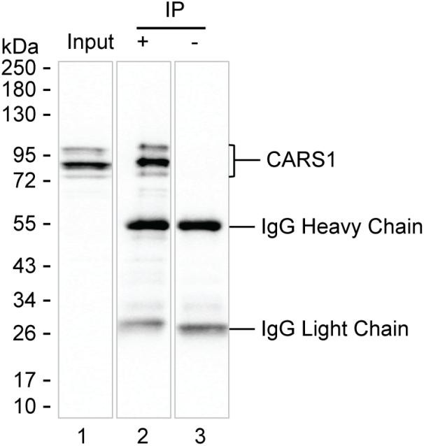 CARS Antibody in Immunoprecipitation (IP)