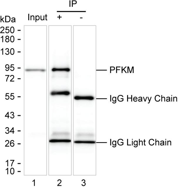 PFKM Antibody in Immunoprecipitation (IP)