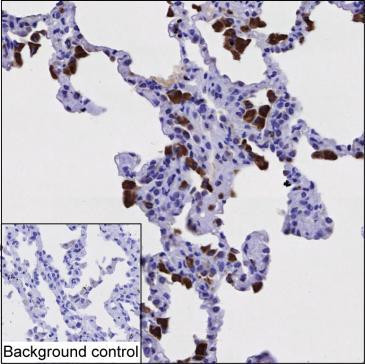 Cathepsin S Antibody in Immunohistochemistry (Paraffin) (IHC (P))