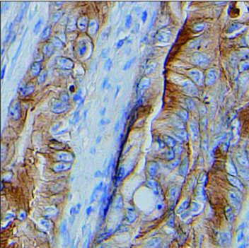 delta Catenin Antibody in Immunohistochemistry (Paraffin) (IHC (P))