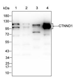 delta Catenin Antibody in Western Blot (WB)