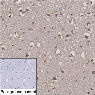 RCAS1 Antibody in Immunohistochemistry (Paraffin) (IHC (P))