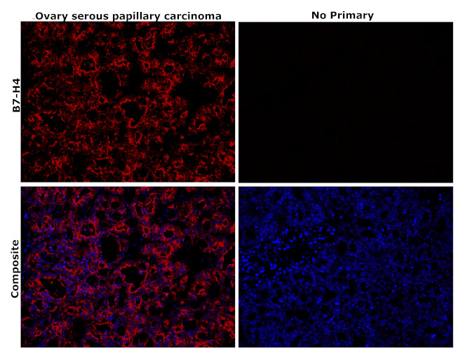 B7-H4 Antibody in Immunohistochemistry (Paraffin) (IHC (P))