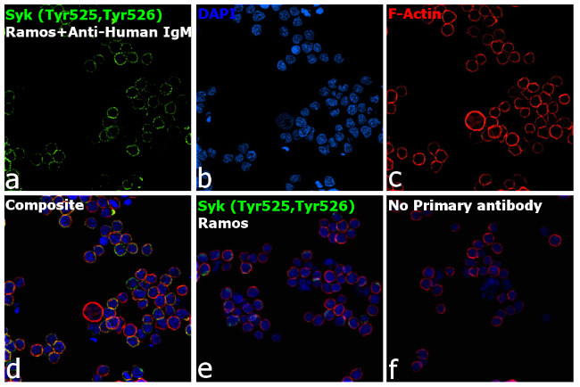 Phospho-Syk (Tyr525, Tyr526) Antibody in Immunocytochemistry (ICC/IF)