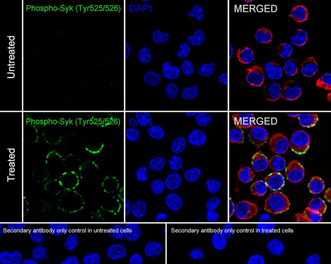 Phospho-Syk (Tyr525, Tyr526) Antibody in Immunocytochemistry (ICC/IF)