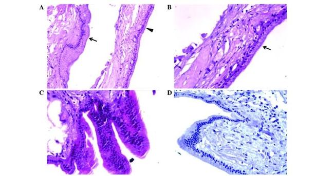 MUC1 Antibody in Immunohistochemistry (Paraffin) (IHC (P))