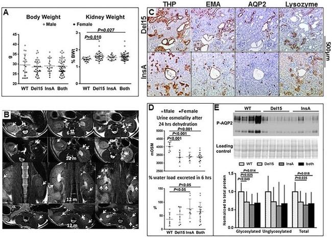 MUC1 Antibody in Immunohistochemistry (IHC)