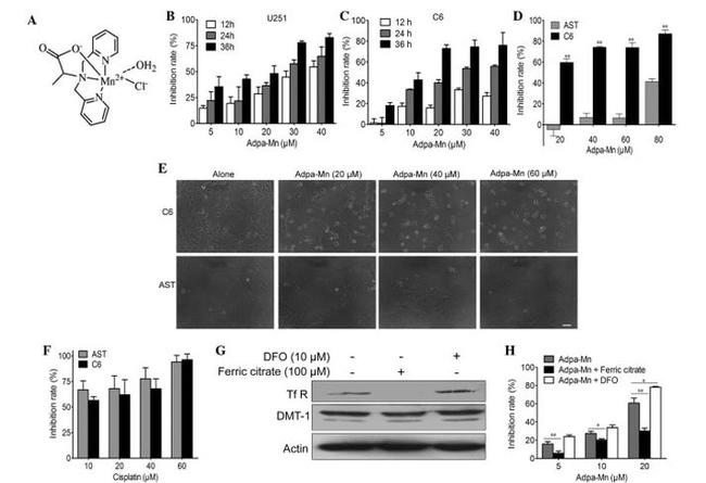 Transferrin Receptor Antibody in Western Blot (WB)