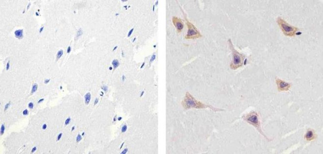 ALK Antibody in Immunohistochemistry (Paraffin) (IHC (P))