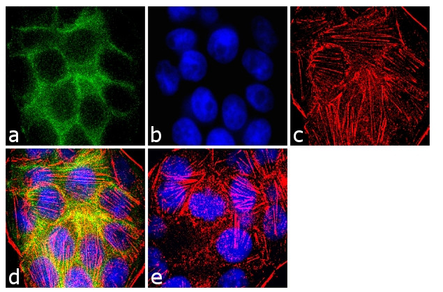 E-cadherin Antibody in Immunocytochemistry (ICC/IF)