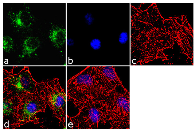 Caspase 6 Antibody in Immunocytochemistry (ICC/IF)