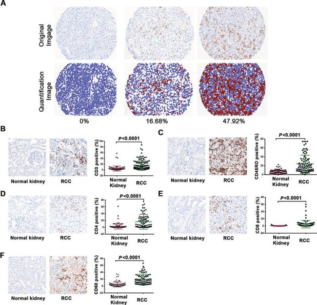 CD45RO Antibody in Immunohistochemistry (IHC)