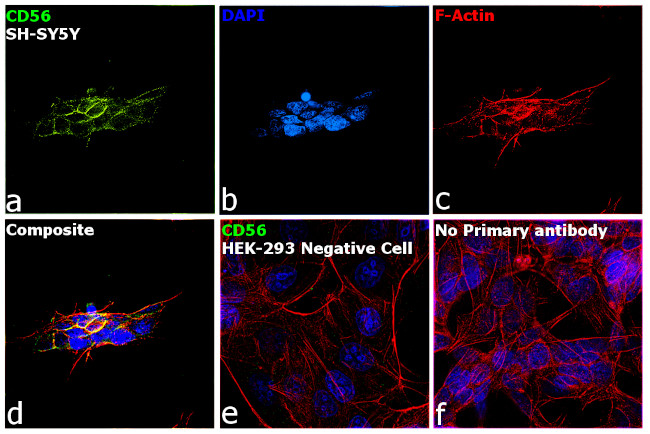 CD56 Antibody