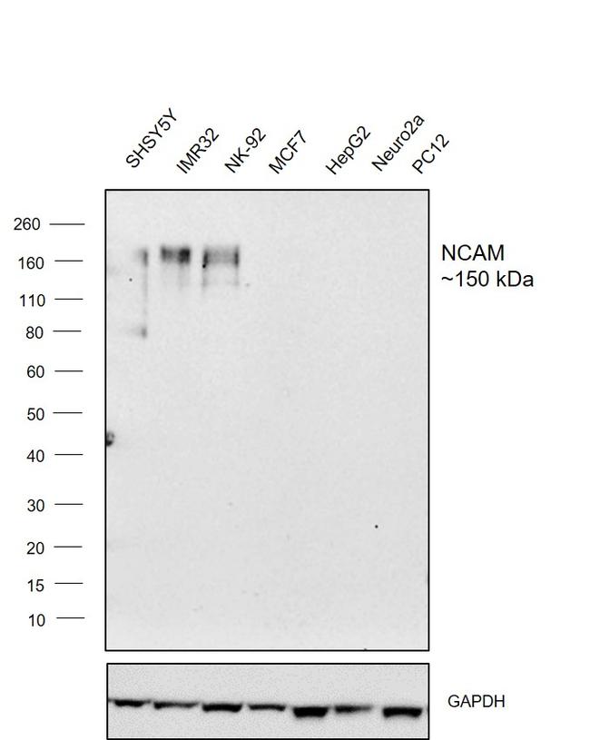 CD56 Antibody in Western Blot (WB)
