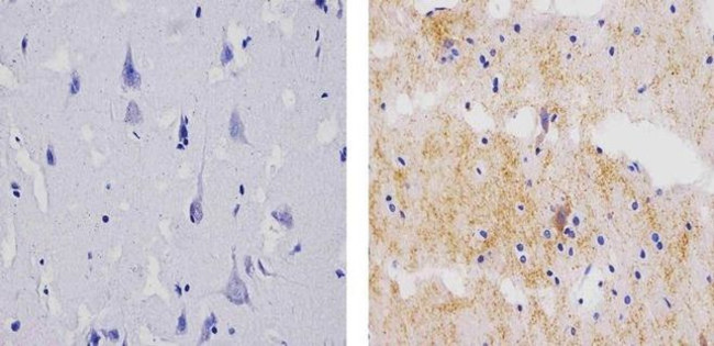 Synaptophysin Antibody in Immunohistochemistry (Paraffin) (IHC (P))