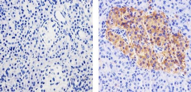 Synaptophysin Antibody in Immunohistochemistry (Paraffin) (IHC (P))