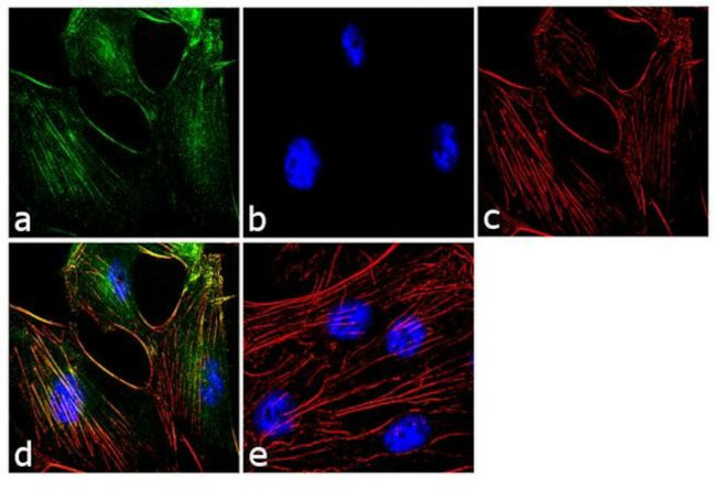 Calponin 1 Antibody in Immunocytochemistry (ICC/IF)