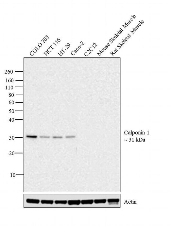 Calponin 1 Antibody in Western Blot (WB)