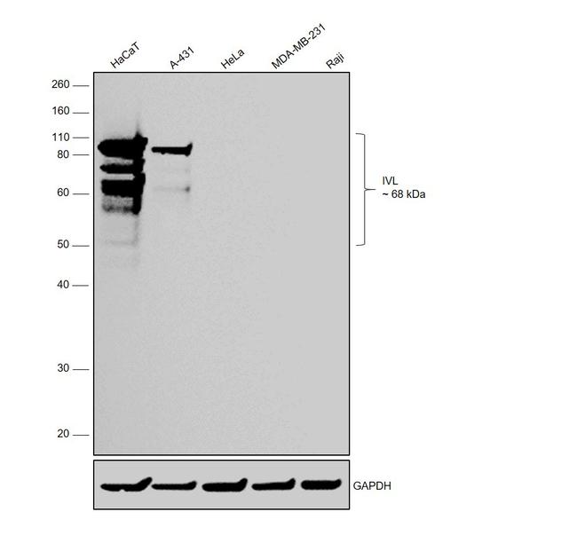 Involucrin Antibody in Western Blot (WB)