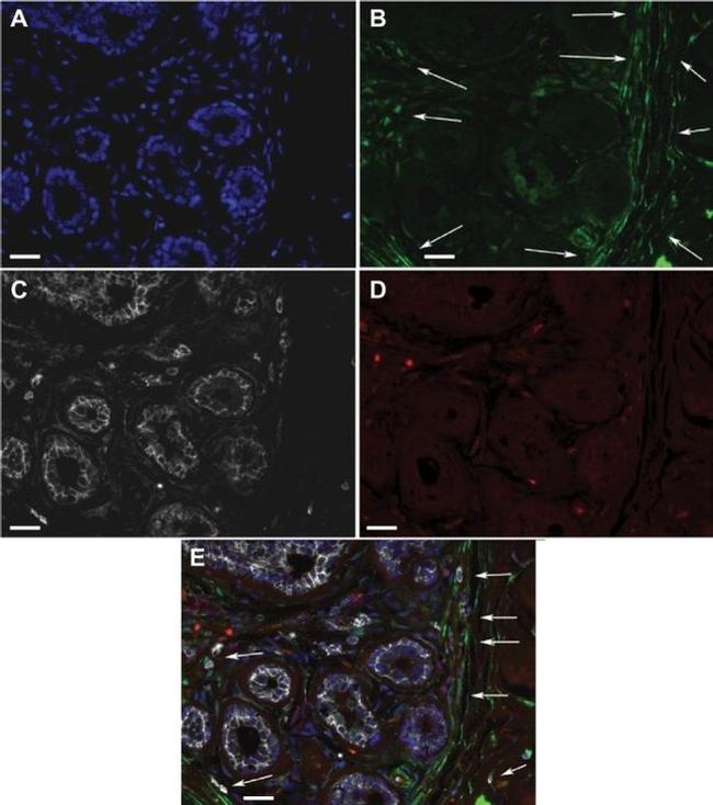 CD44 Antibody in Immunohistochemistry (IHC)