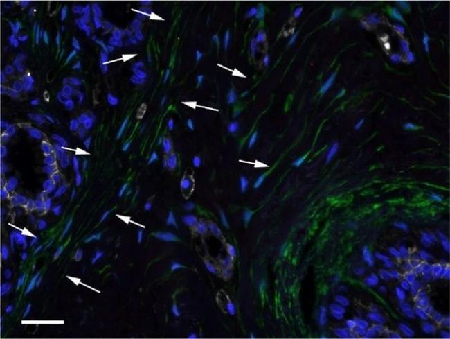 CD44 Antibody in Immunohistochemistry (IHC)