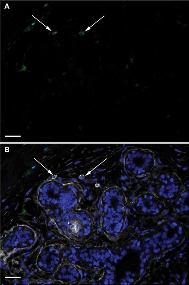 CD44 Antibody in Immunohistochemistry (IHC)