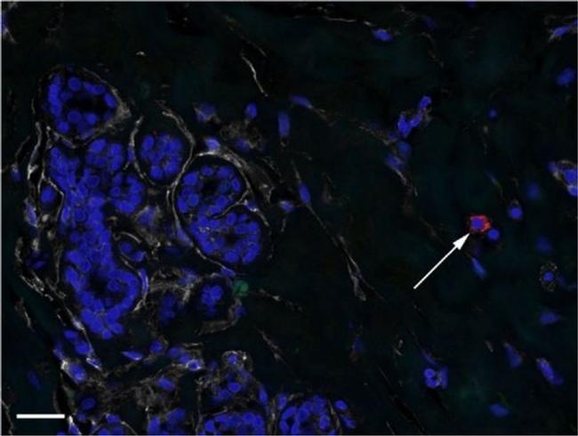 CD44 Antibody in Immunohistochemistry (IHC)