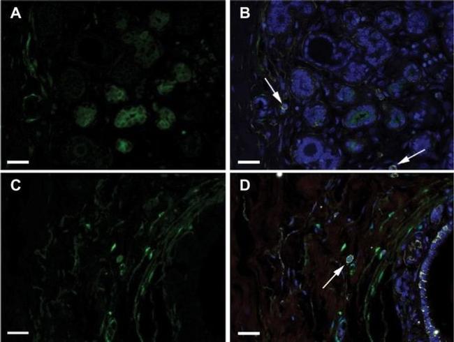 CD44 Antibody in Immunohistochemistry (IHC)