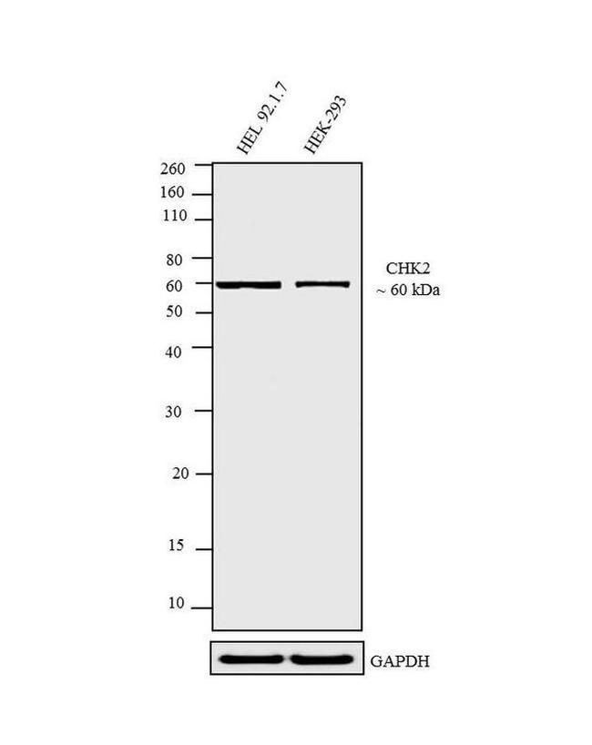 CHK2 Antibody in Western Blot (WB)