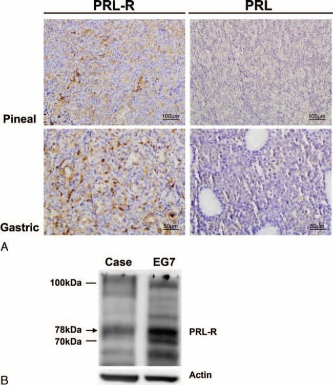 Prolactin Receptor Antibody in Western Blot, Immunohistochemistry (WB, IHC)