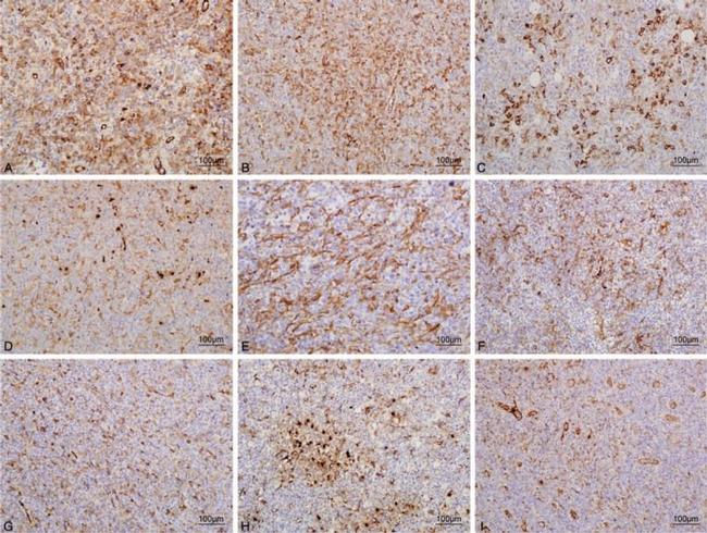 Prolactin Receptor Antibody in Immunohistochemistry (IHC)