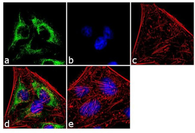 Cytokeratin 7 Antibody in Immunocytochemistry (ICC/IF)