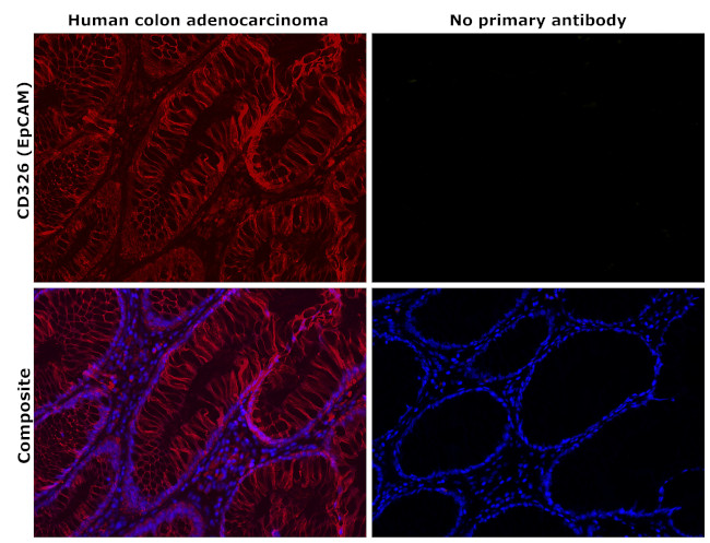 EpCAM Antibody in Immunohistochemistry (Paraffin) (IHC (P))