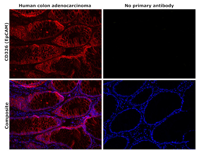 EpCAM Antibody in Immunohistochemistry (Paraffin) (IHC (P))