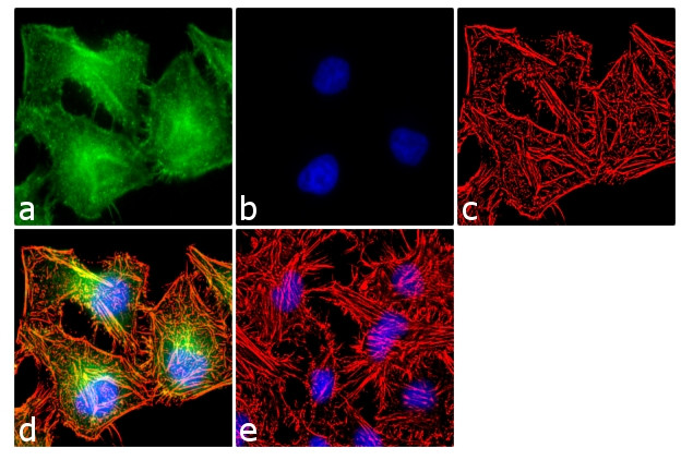 EpCAM Antibody in Immunocytochemistry (ICC/IF)