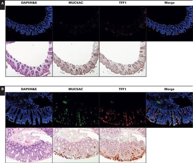 MUC5AC Antibody in Immunohistochemistry (IHC)