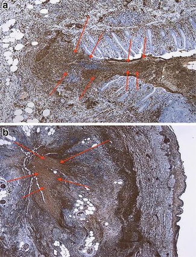 Calprotectin Antibody in Immunohistochemistry (Paraffin) (IHC (P))