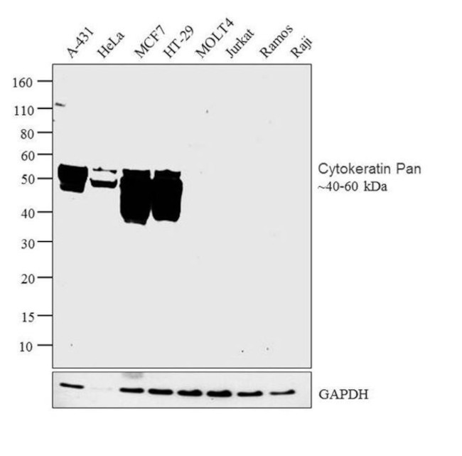 Cytokeratin Pan Antibody