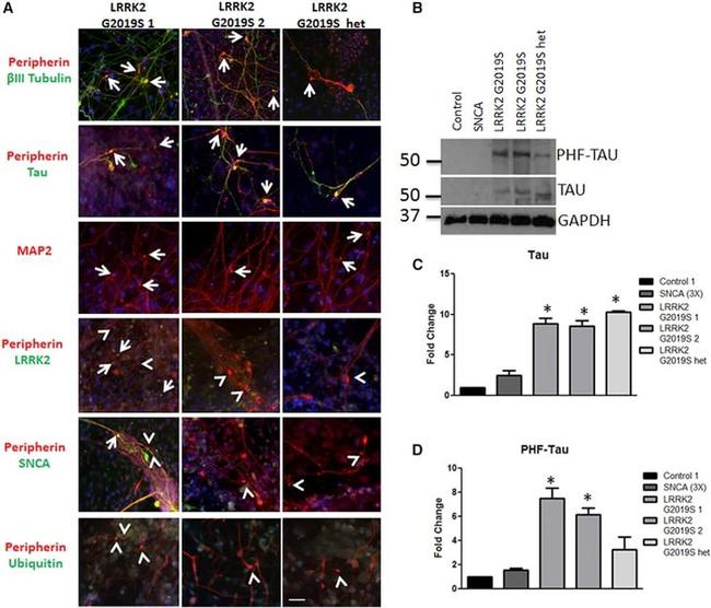 alpha Synuclein Antibody in Immunocytochemistry (ICC/IF)